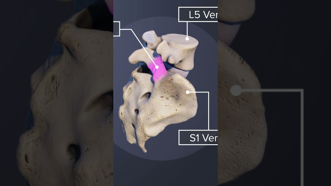Facet Joints of the L5-S1 Spinal Motion Segment