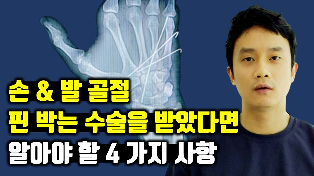 손 발 골절에 대한 '핀 삽입 수술', 정형외과 전문의에게 직접 듣는 유의사항