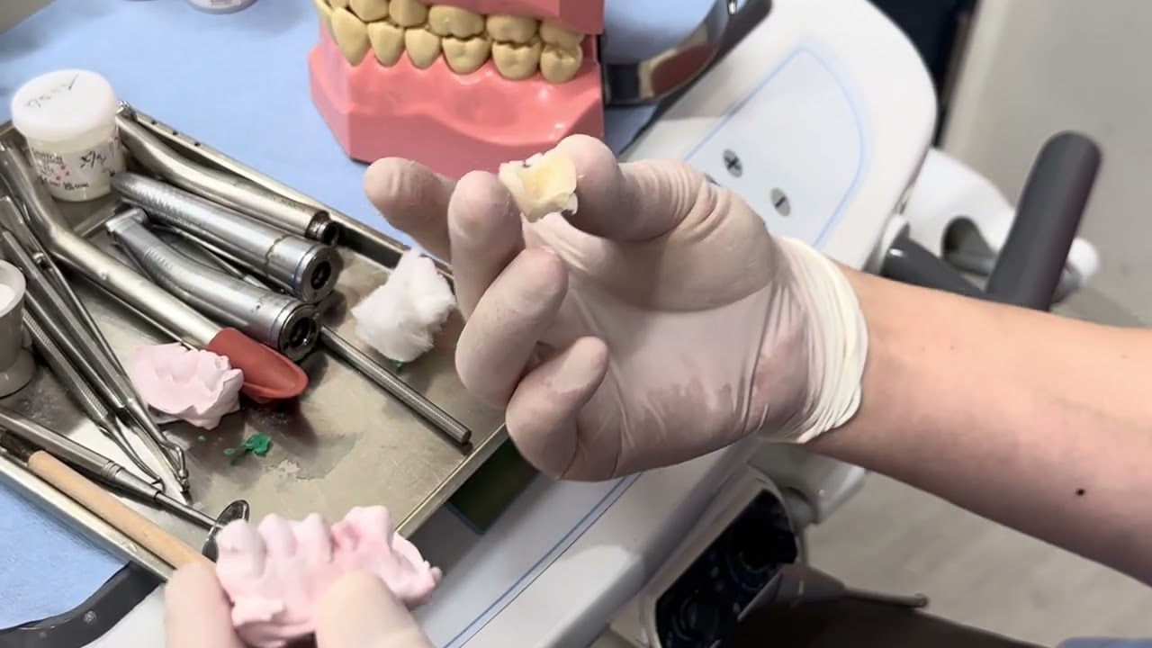左上6番院内仮歯作成(3/12)即重の硬化待ちにすべきこと