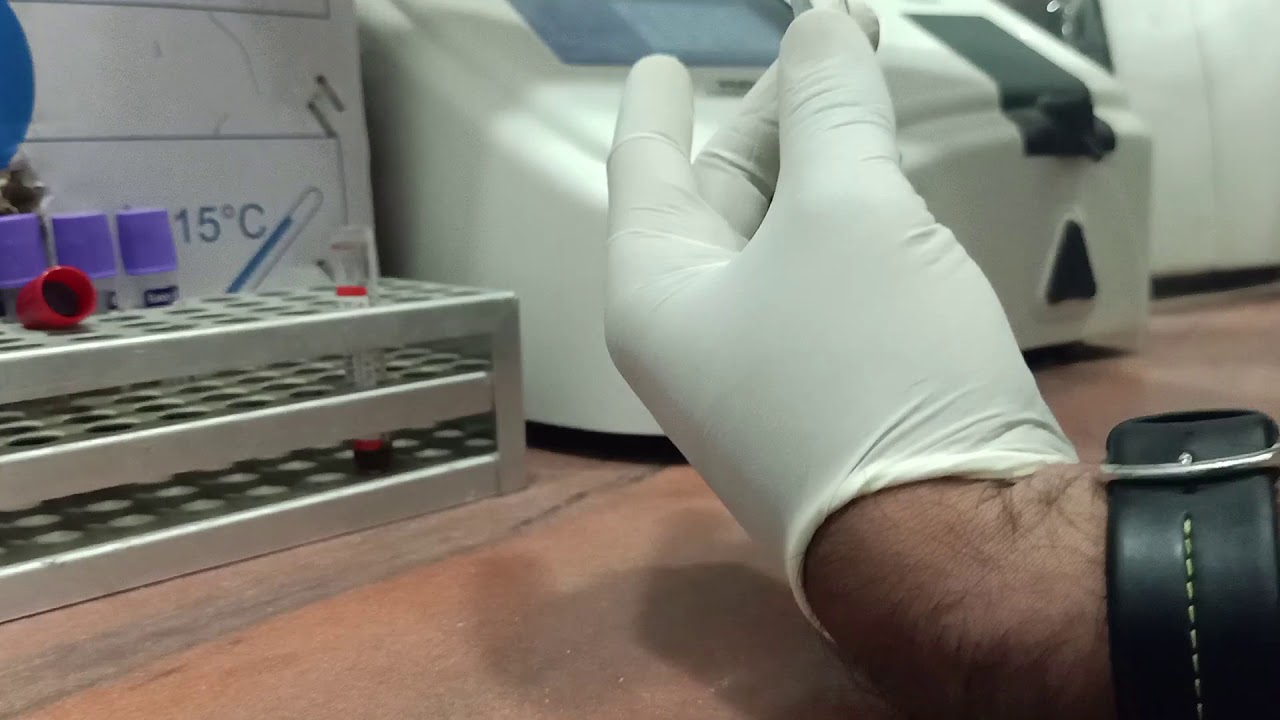 SGPT, SGOT TEST