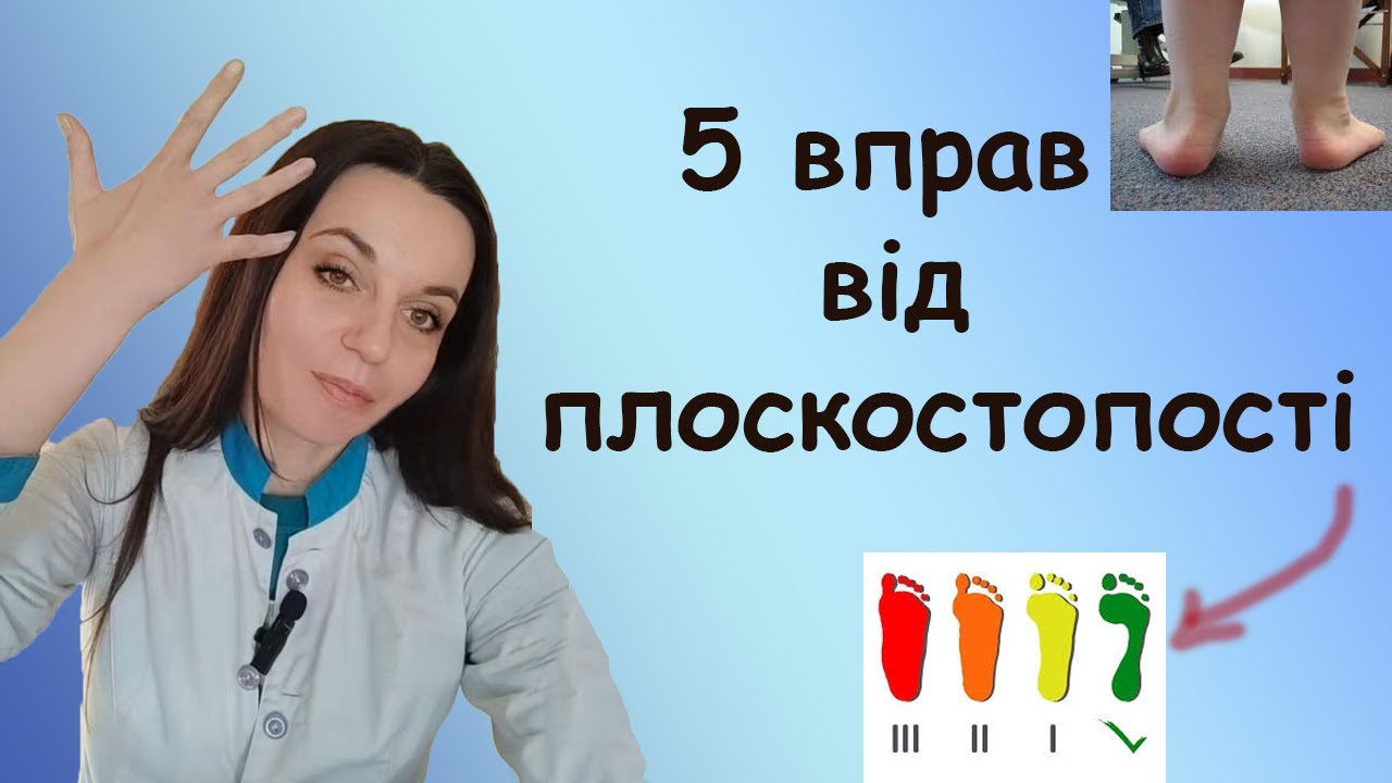 Поздовжня  плоскостопість вправи для дітей і дорослих щоб запобігти плоскостопості і лікувати наявну