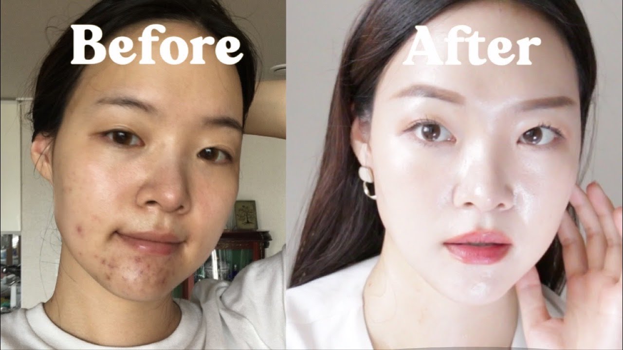 Things I wish I knew about skincare