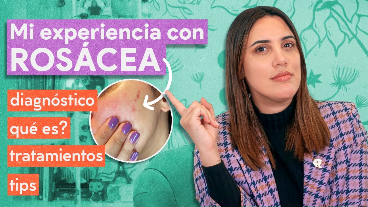 Mi experiencia con ROSÁCEA. Qué es, diagnóstico, tratamientos, tips y cómo armar una rutina