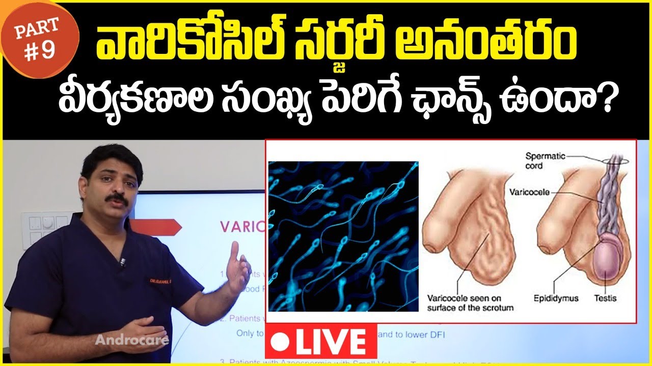 Can Sperm Count Increase After Varicocele Surgery || Dr Rahul Reddy || Androcare Andrology Clinic