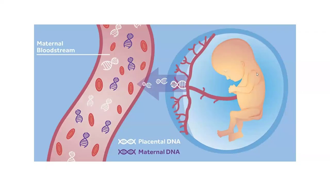 Prenatal Cell Free DNA Screening