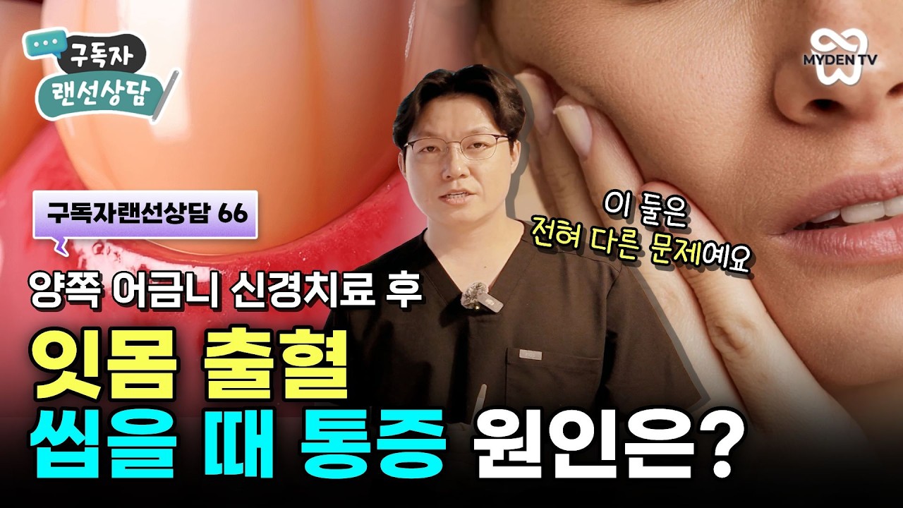 지속되는 씹을 때 통증과 잇몸 출혈, 원인이 무엇일까? | 구독자랜선상담 66
