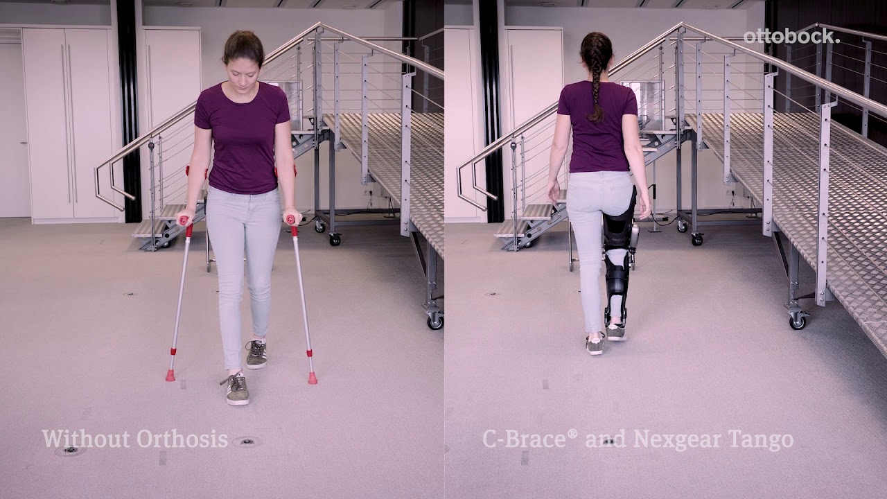 Denise C-Brace Gait Comparison Video | Ottobock