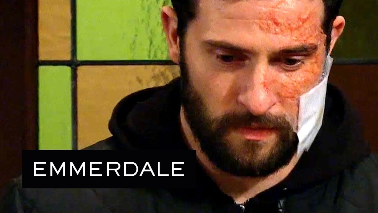 Emmerdale - Ross Becomes the Victim of a Horribly Cruel Bet