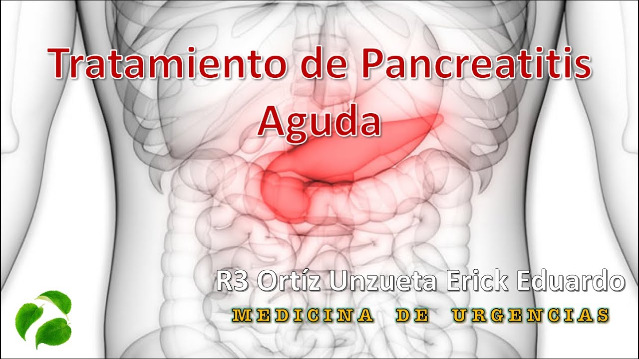 Tratamiento de la Pancreatitis Aguda en el Servicio de Urgencias
