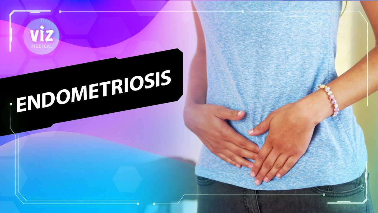 Endometriosis Explained (3D Animation)