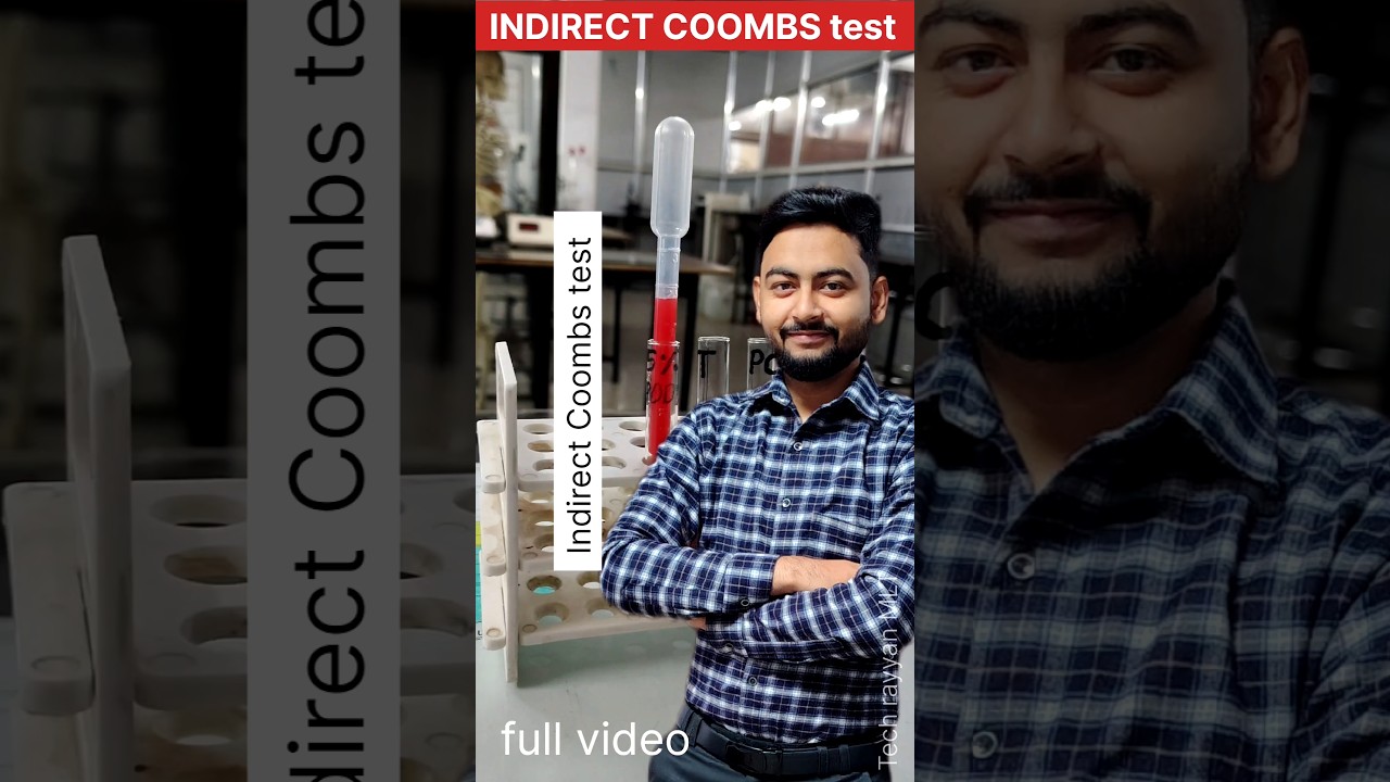 Indirect Coombs test practical video|| #labtechnician #trendingshorts