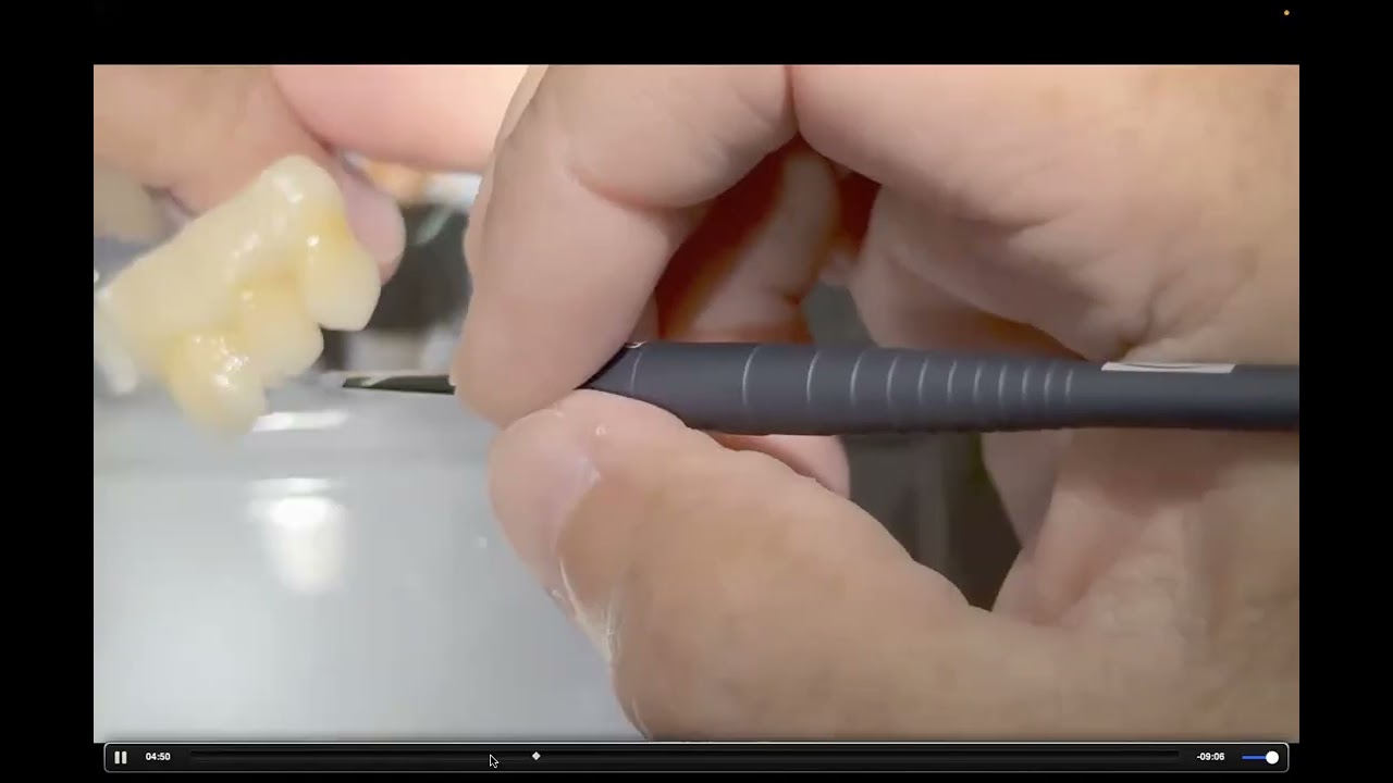 Smart Staining: Elevated Yet Efficient Techniques for Zirconia Esthetics