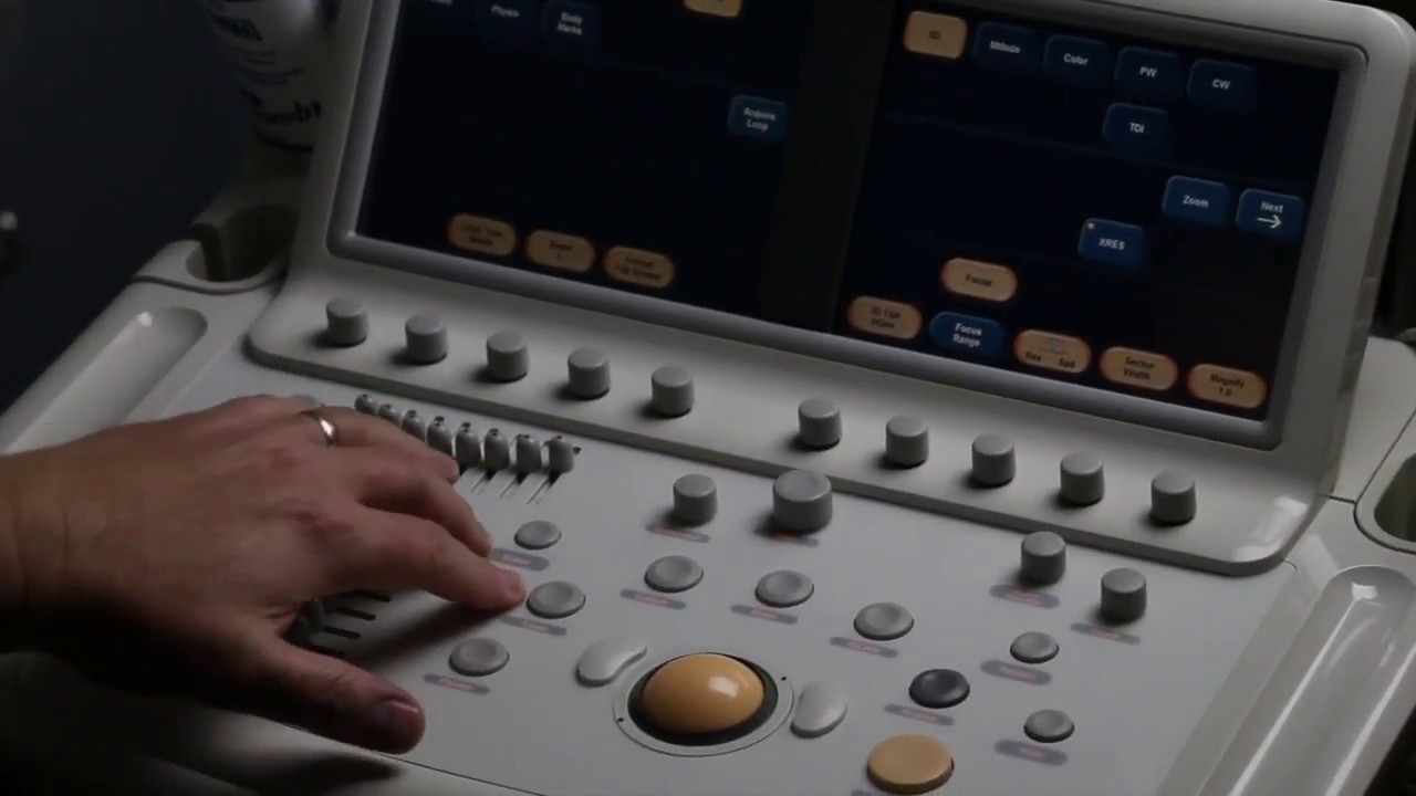 Philips iE33 Ultrasound System – Service & Repair