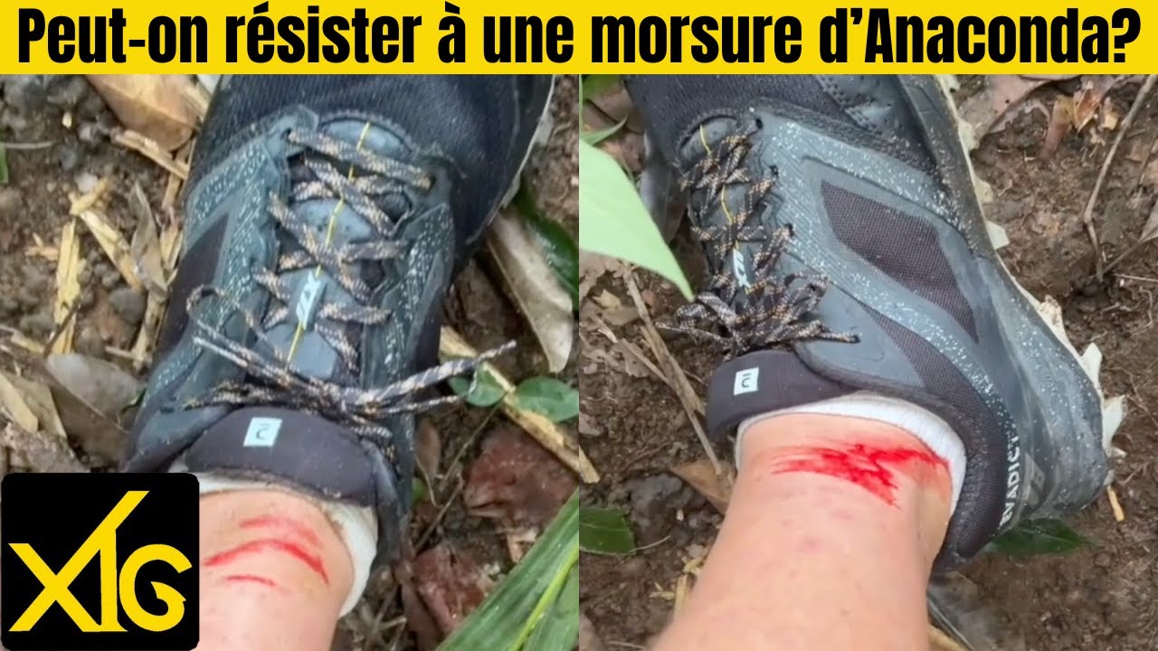 730 Cette blessure me conduira à l'hôpital de Caracas #venezuela #danger