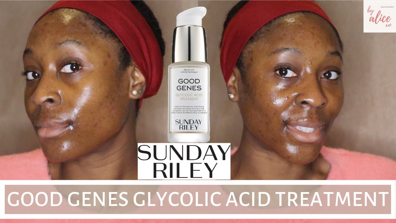 SUNDAY RILEY GOOD GENES GLYCOLIC ACID TREATMENT FACE MASK | GLYCOLIC ACID FOR DARK SKIN | byalicexo