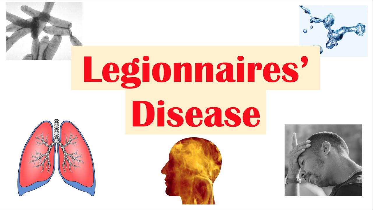 Legionnaires’ Disease | Causes, Pathophysiology, Symptoms, Diagnosis, Treatment