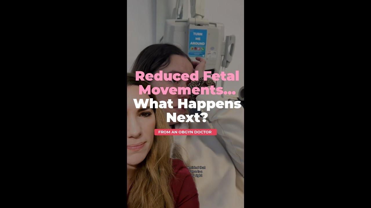 Reduced Fetal Movements
