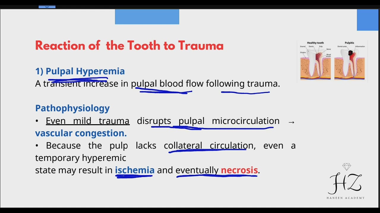 Pedodontics 5th lec 9 Reaction of the tooth to trauma ( part 1 ) 💙
