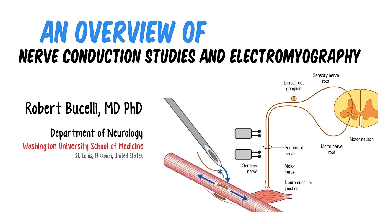 An Overview of Nerve Conduction Studies and Electromyography (Feat. Dr. Bucelli)