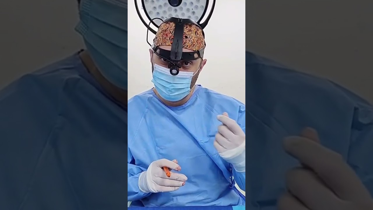 عملية تجميل أنف لحمي