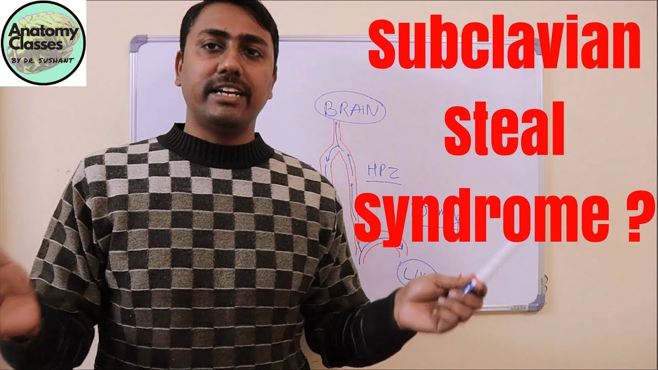 Anatomical basis of Subclavian Steal Syndrome