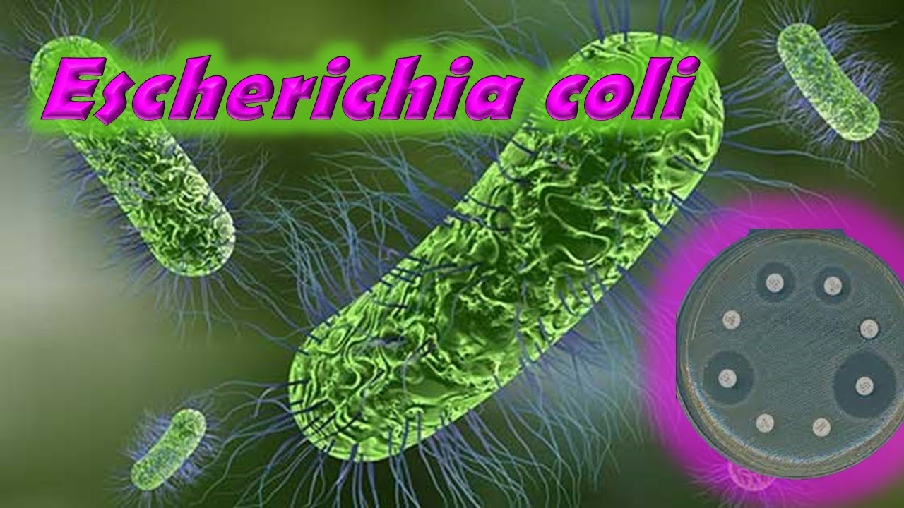 Escherichia coli y el Antibiograma