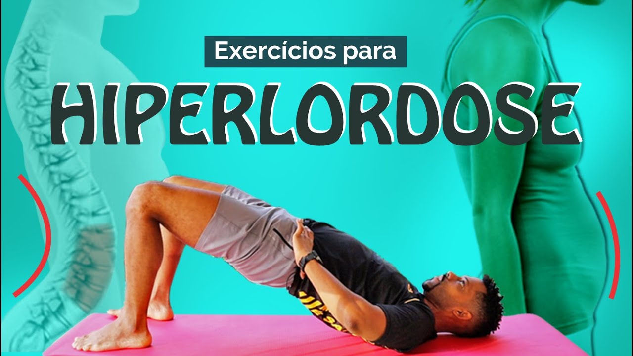 HIPERLORDOSE LOMBAR - Exercícios para corrigir o aumento da curvatura lombar e a barriga pra frente