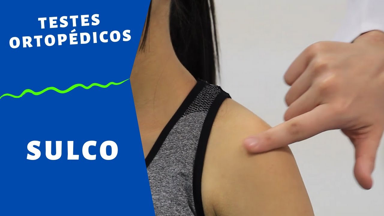 Sulco