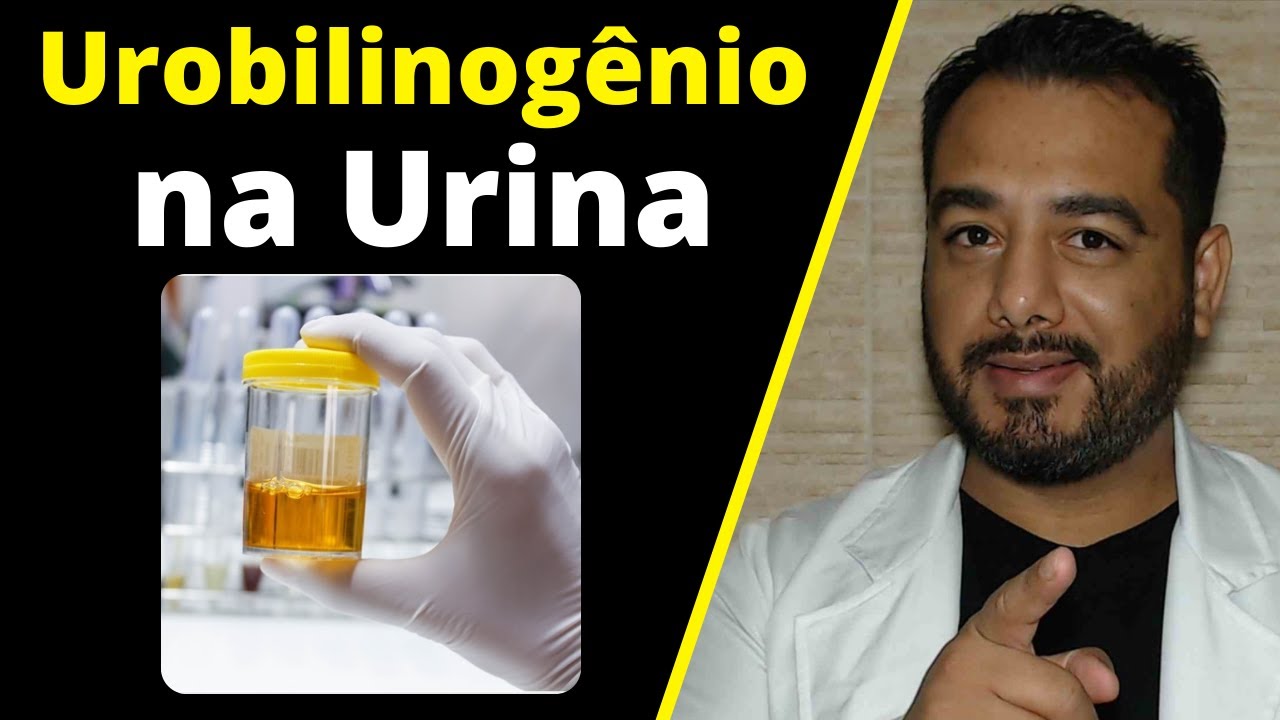 Presença de Urobilinogênio na Urina: o que Pode Ser? E Ausência? Pigmentos Biliares | Exame de Urina