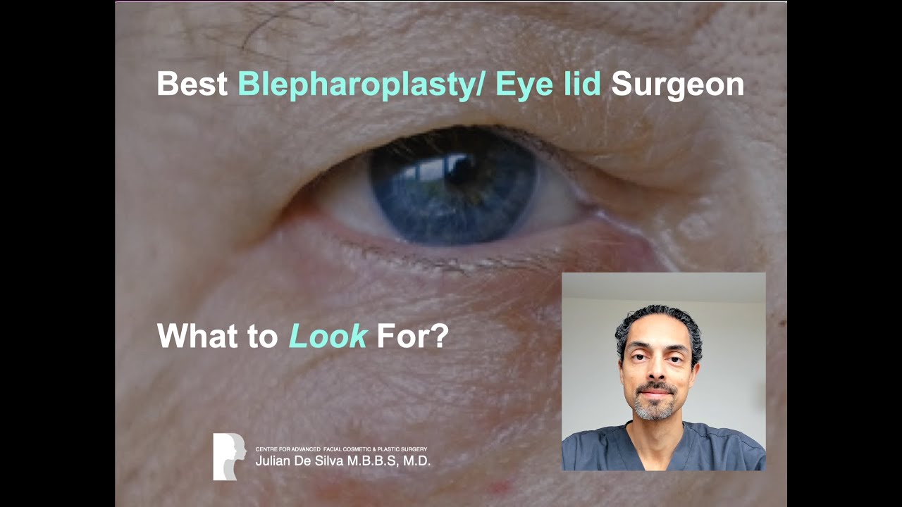 How to choose the Best Eyelid/ Blepharoplasty surgeon for you? What to look for and avoid ...
