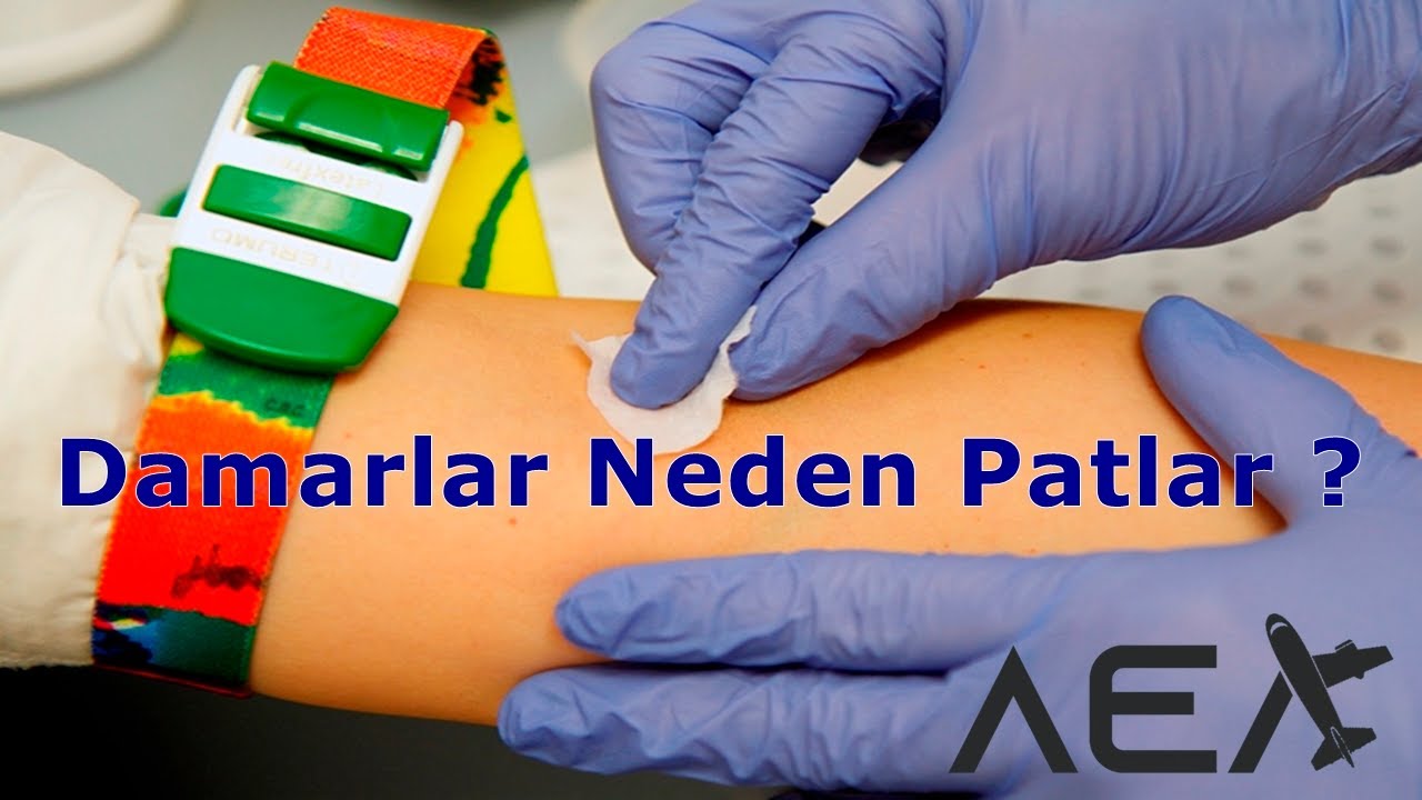 Damar Yolunun Mantığı - 1 (Damarlar Neden Patlar?)