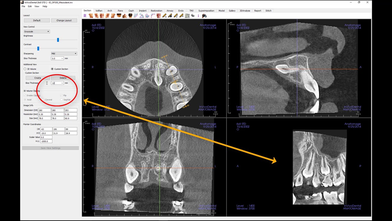 Invivo™ 6 Tutorial - Section View - Getting Started, Part 3
