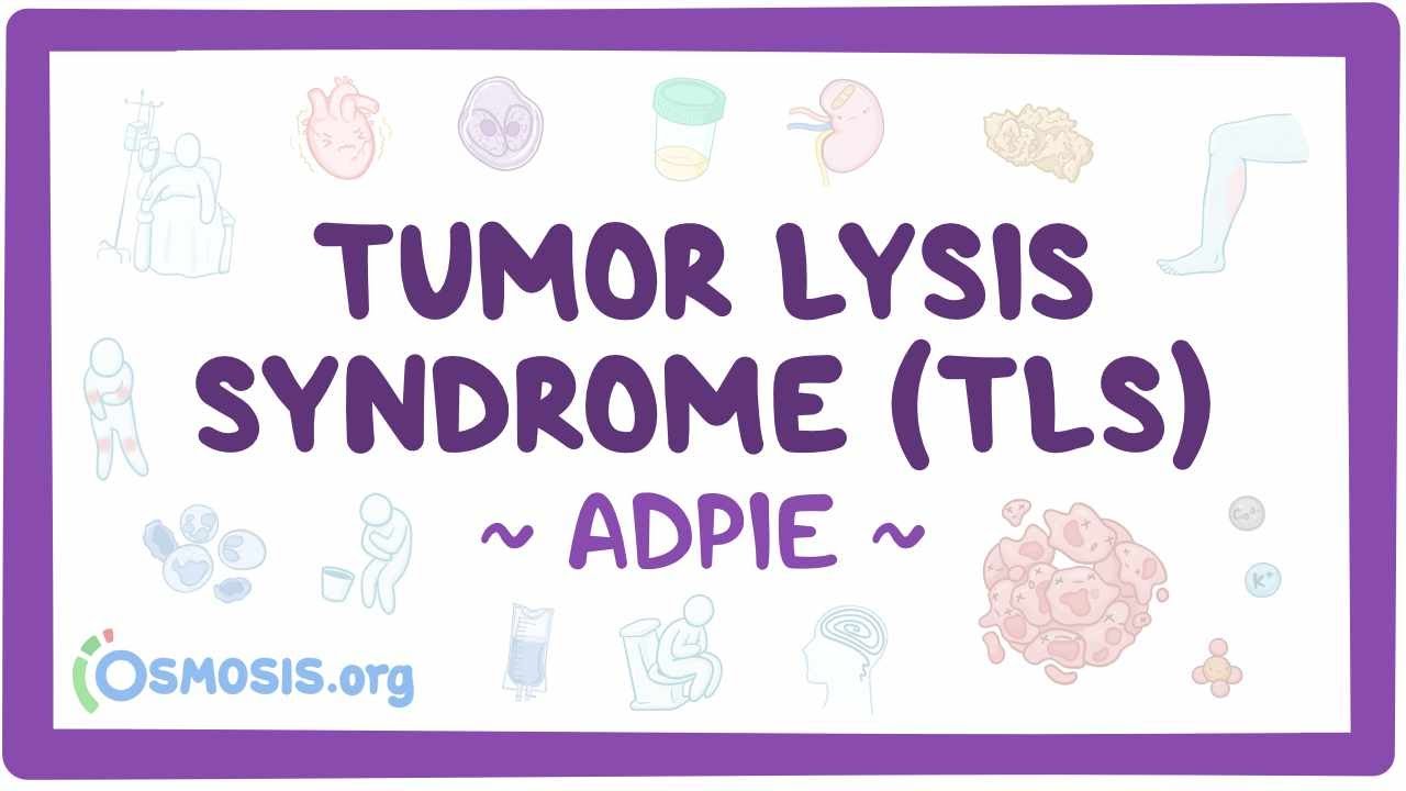 Tumor lysis syndrome (TLS): Nursing Process (ADPIE)
