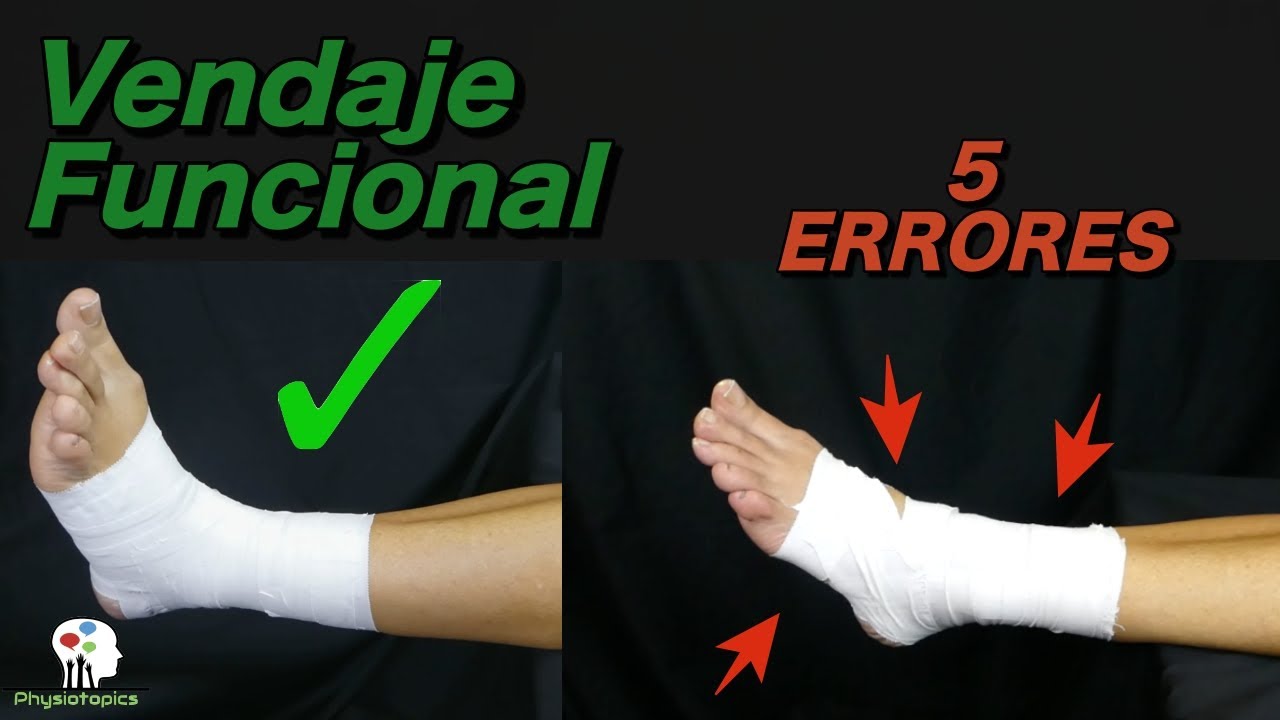 Errores comunes del Vendaje Funcional