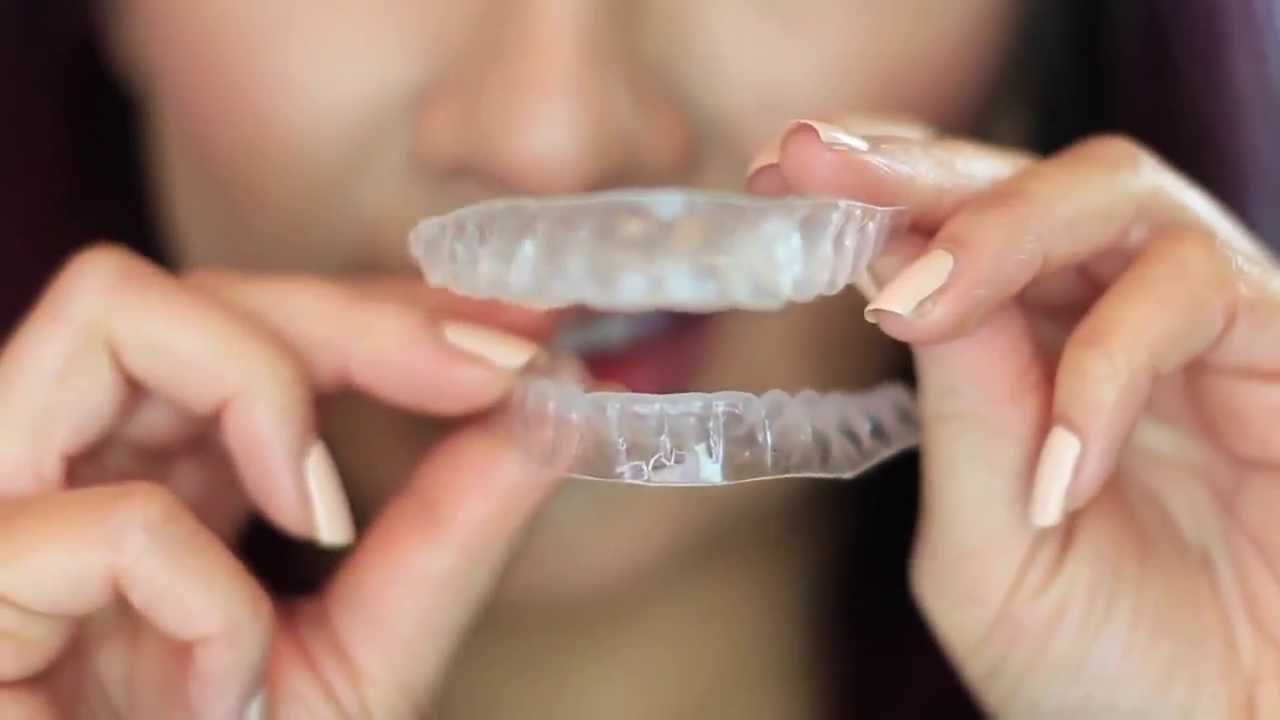 Dental Work & Teeth Whitening Review by Lisa Pullano