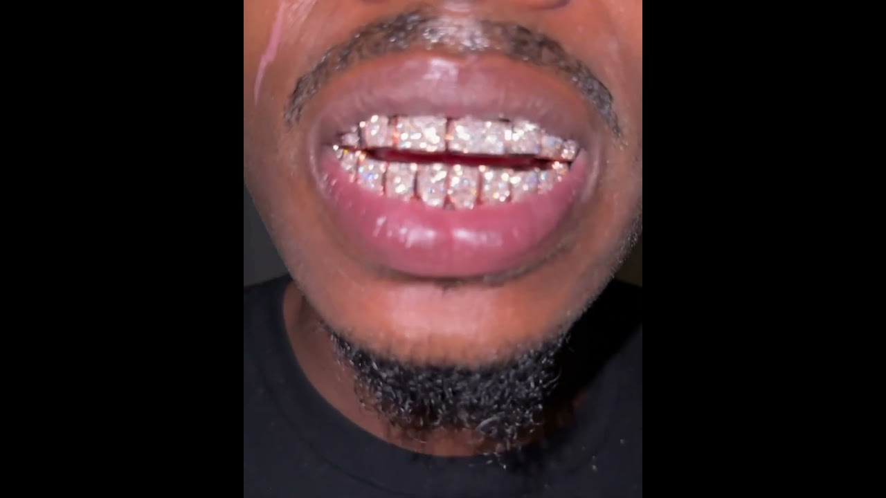 18k Rose Gold Diamond Permanent Teeth VVS Est Gee Type Grillz #estgee #johnnydang #grillz #cmg