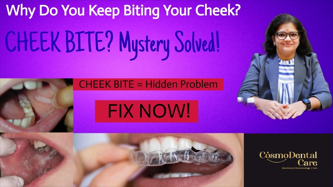 Cheek bite again and again? 😣#cheekbite #dentalcare