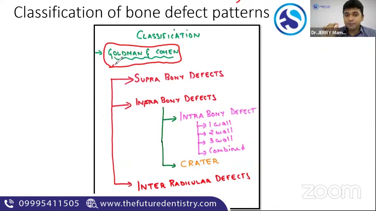 FOCUS THE FUTURE DENTISTRY  PATTERN OF BONE DESTRUCTION BY DR JERRY