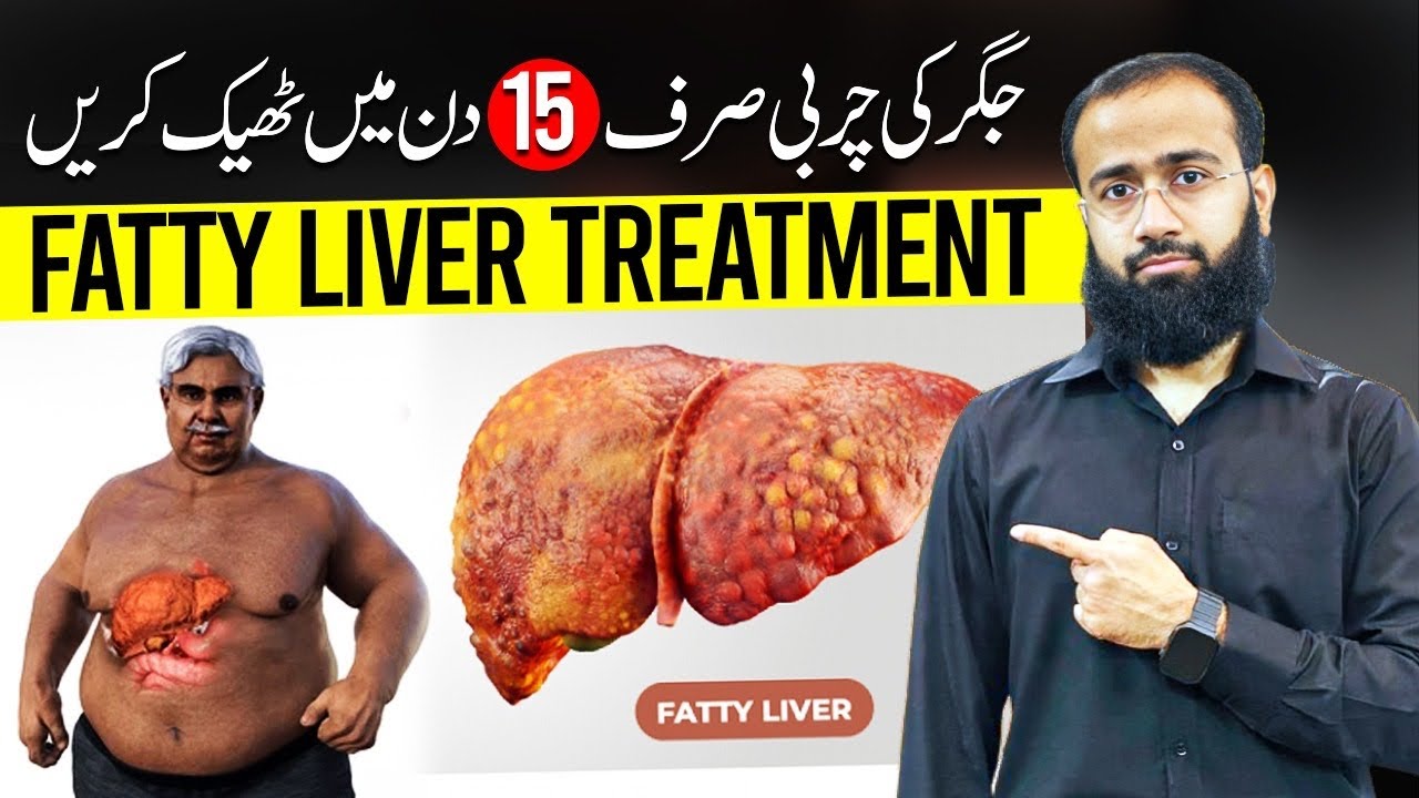 Reverse Fatty Liver Naturally | Home Remedies & Prevention Tips