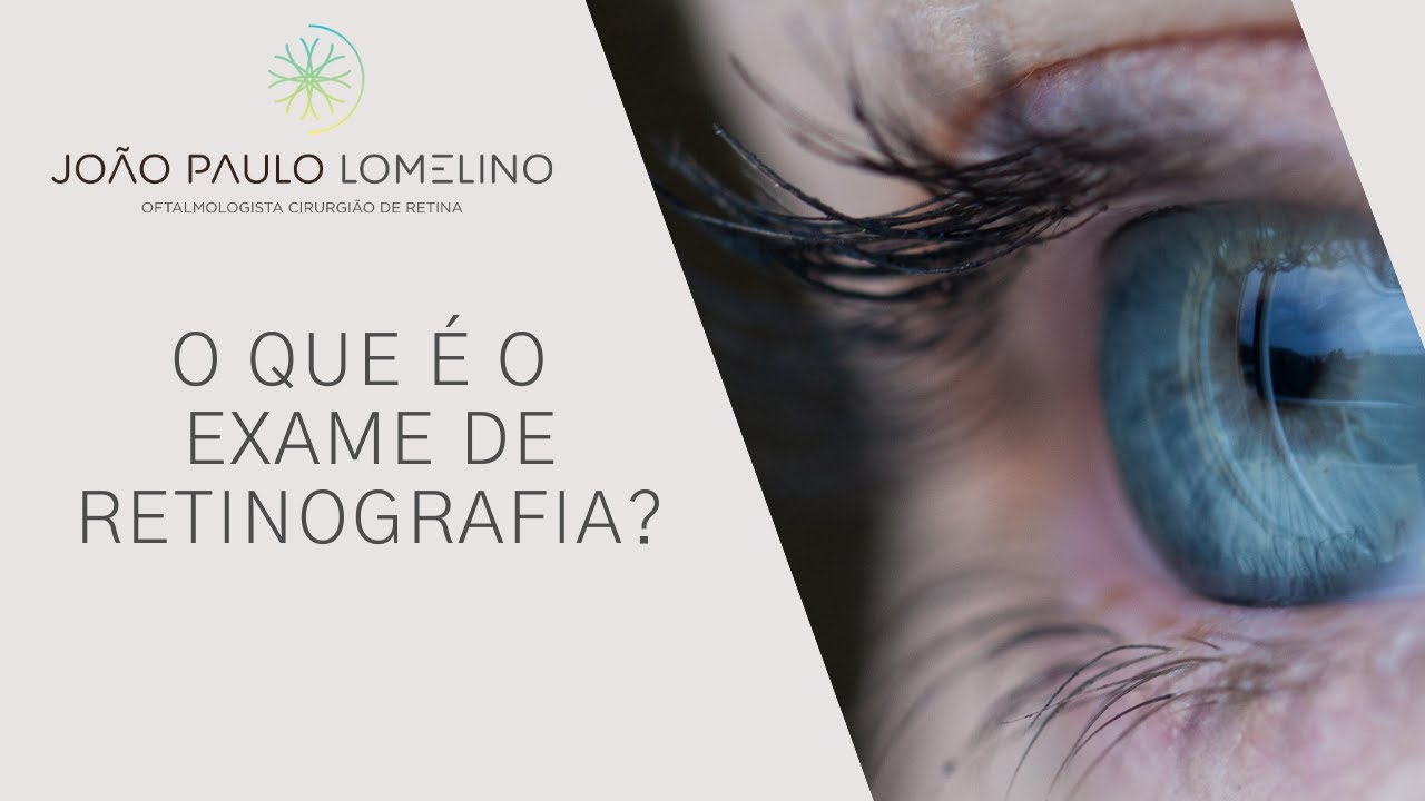 O que &eacute; o exame de retinografia? | Dr. Jo&atilde;o Paulo Lomelino
