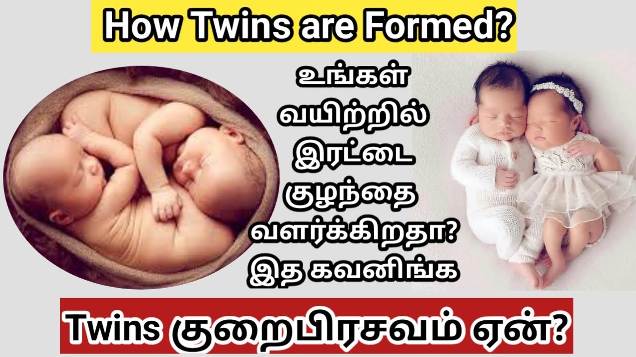 Monochorionic diamniotic twins|Dichorionic diamniotic twins