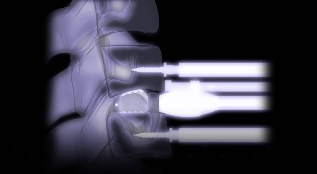 ROI-C Technique Animation