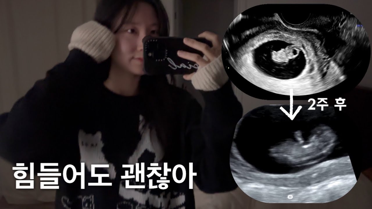 (VLOG) 입덧 중 회사 다니기 8-10주차 [임신일기 3화]
