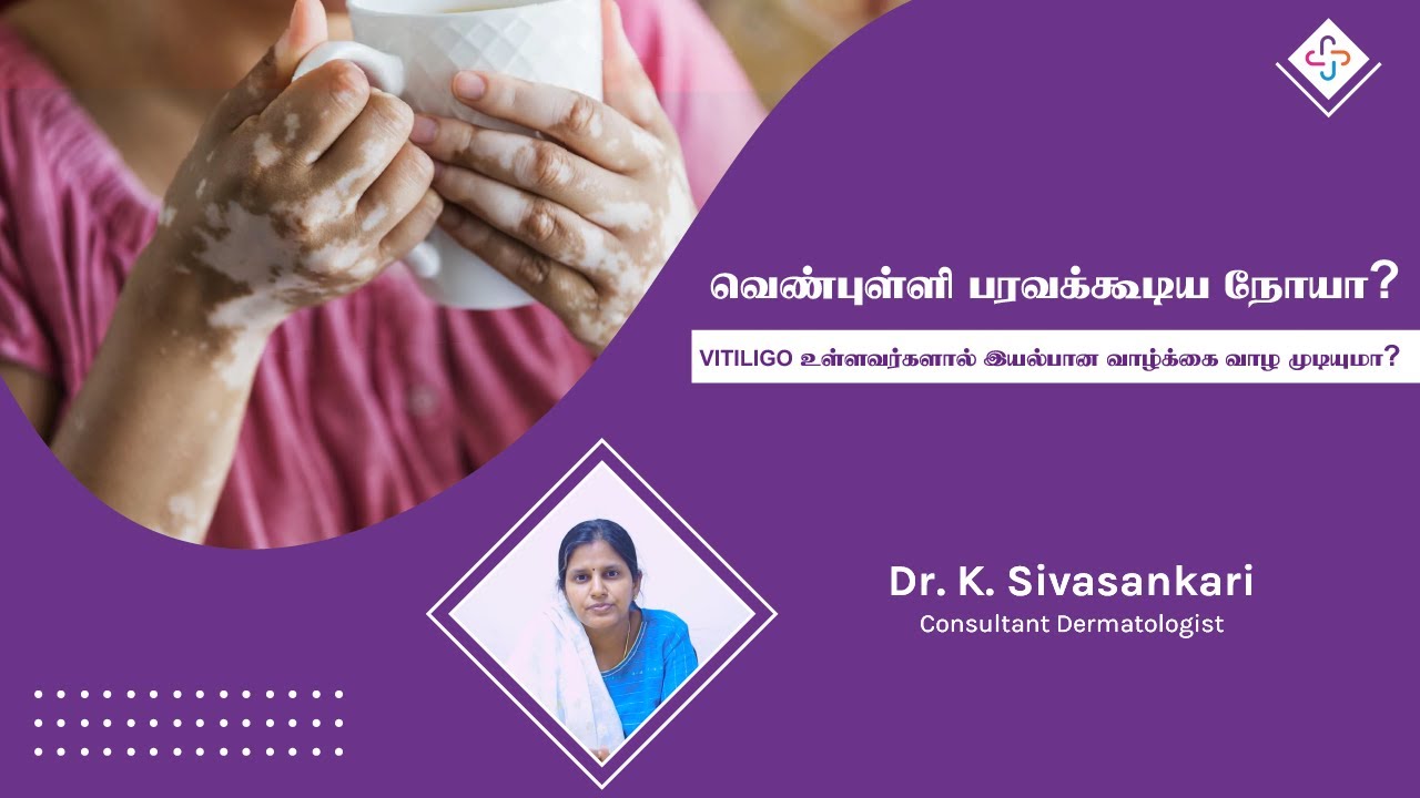 வெண்புள்ளி பரவக்கூடிய நோயா? VITILIGO உள்ளவர்களால் இயல்பான வாழ்க்கை வாழ முடியுமா?