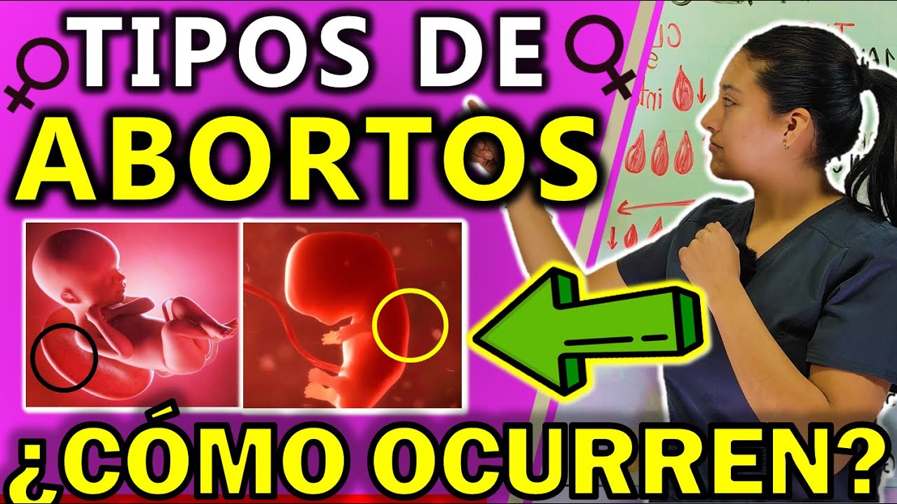 TIPOS DE ABORTOS Y EN QUE CONSISTEN | GuiaMed