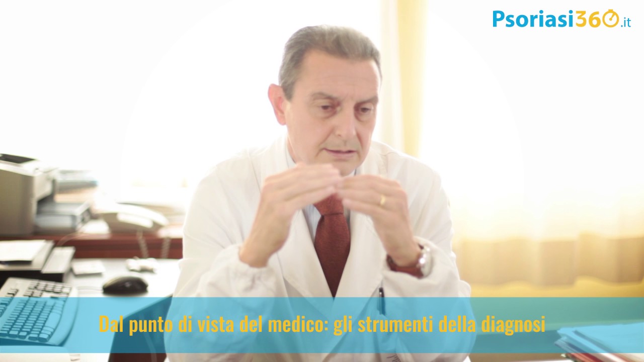 Comprendere l’artrite psoriasica
