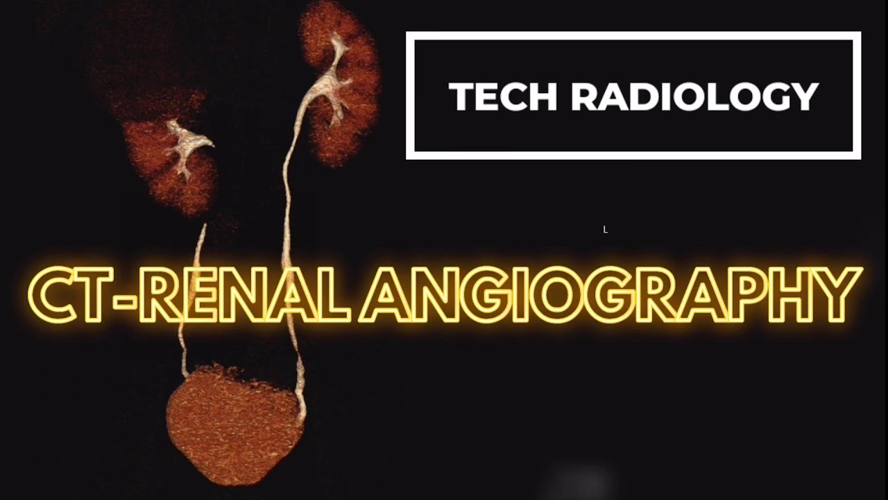 CT RENAL ANGIOGRAPHY/KUB CONTRAST/KUB/KIDNEY DISEASE/KIDNEY