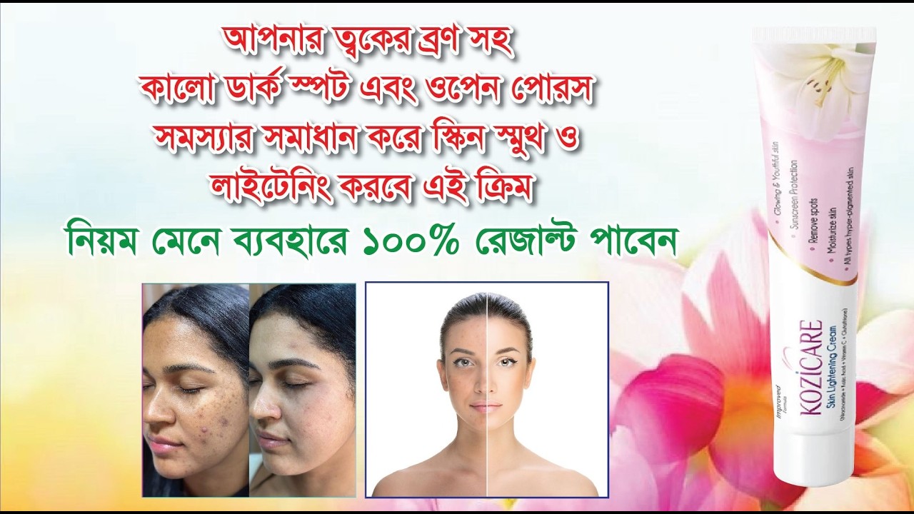 ত্বক ফ*র্সা ও মুখের দাগ দূর করার ডাক্তারি ক্রিম।।Kozicare Skin Lightening Cream In BD 2026