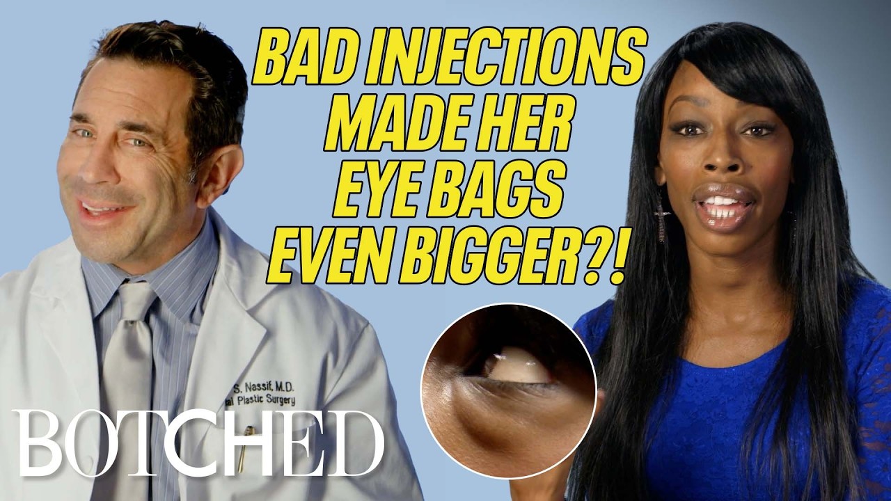 Myesha Had Bootleg Filler Injected Under Her EYES?! (Before & After) | Botched | E!