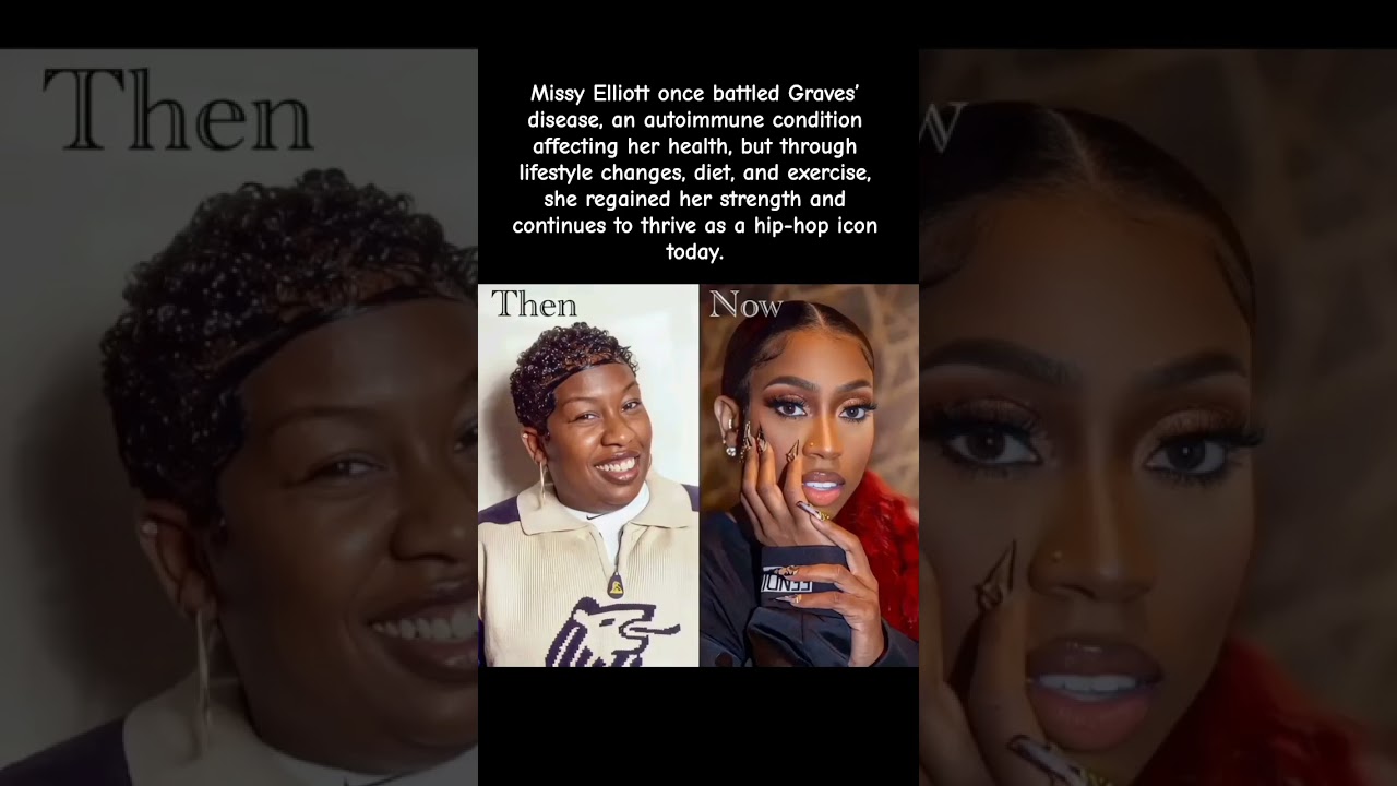 &ldquo;Missy Elliott Overcame Graves&rsquo; disease And Came Back Stronger 😮&zwj;🔥&rdquo; #celebrity